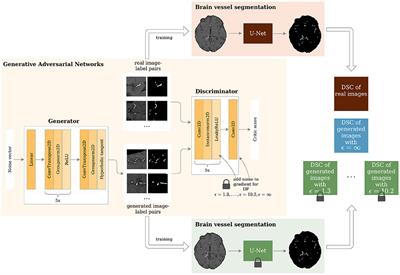 Toward Sharing Brain Images: Differentially Private TOF-MRA Images With Segmentation Labels Using Generative Adversarial Networks